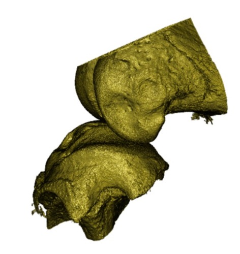 High resolution, surface rendered X-ray computerised tomography image of a mouse knee joint