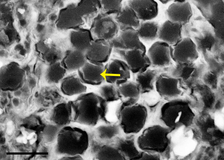 electron micrograph of fossil tissue