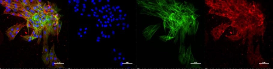 Figure 2: fluorescent images showing merged, dapi, phalloidin and P65 antibodies staining of inhibitor 2 and all three cytokines stimulated adult tendon cells.