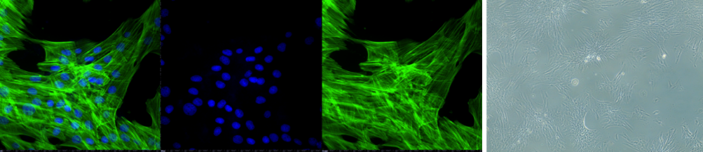 Figure 3: fluorescent images showing merge, dapi and phalloidin staining, plus a bright field image of inhibitor 3 and cytokine stimulated adult tendon cells