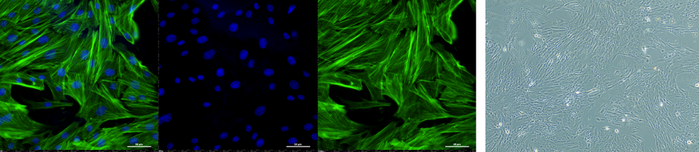 Figure 4: fluorescent images showing merge, dapi and phalloidin staining, plus a bright field image of inhibitor 4 and cytokine stimulated adult tendon cells