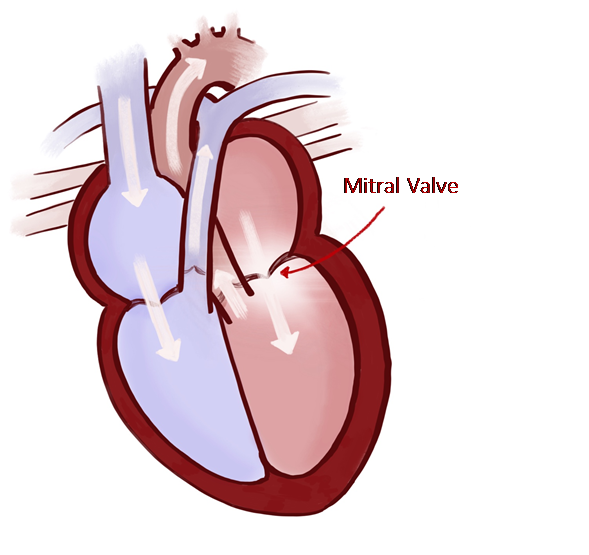 RVC Mitral Valve Disease In Dogs