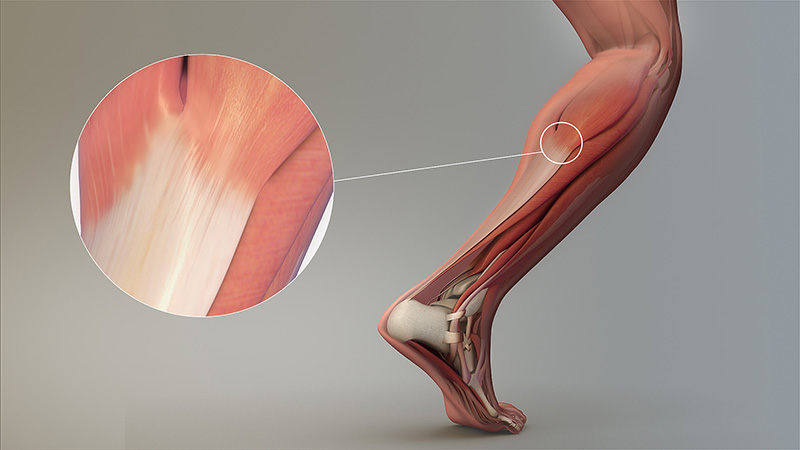 human lower-leg tendons