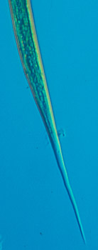 Haemonchus contortus tail