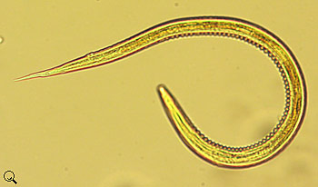 Trichostrongylus