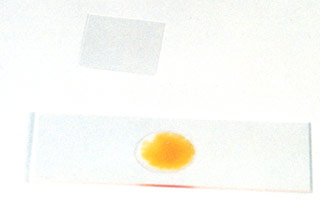 slide with drop of sedimented fluid and iodine with coverslip separate